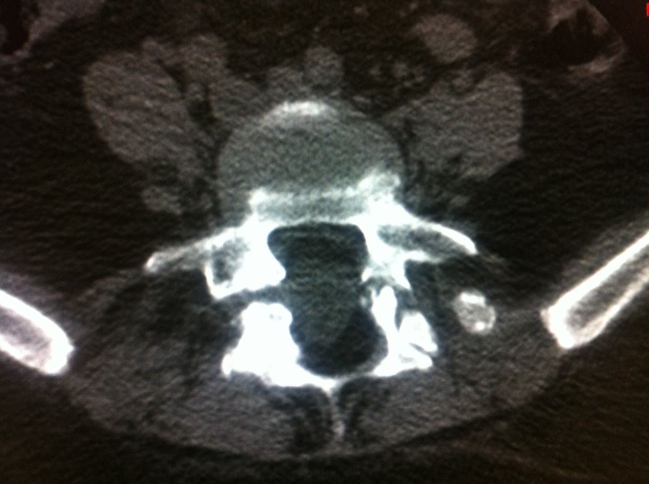 photo INTERVENTIONAL RADIOLOGY