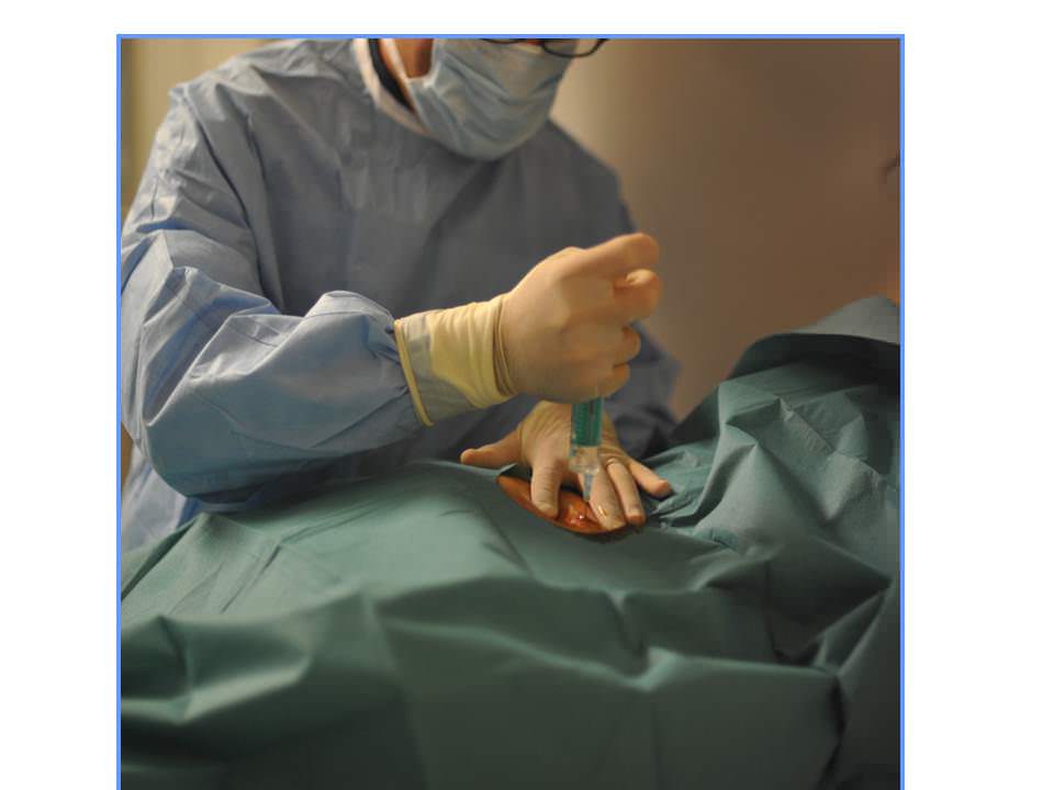 figure 4 anesthesie locale INTERVENTIONAL RADIOLOGY