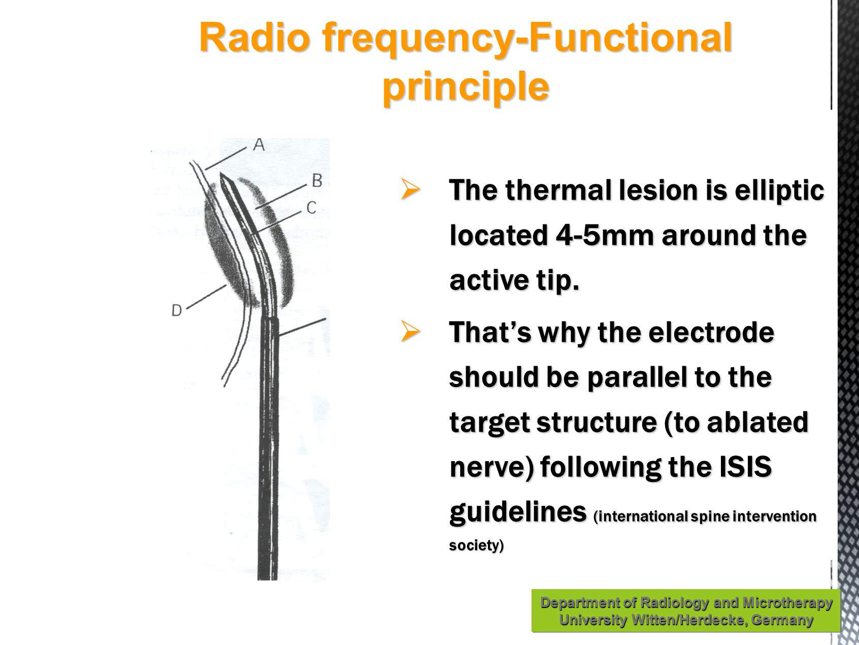 Rhizolyse articulaire posterieure interventional radiology